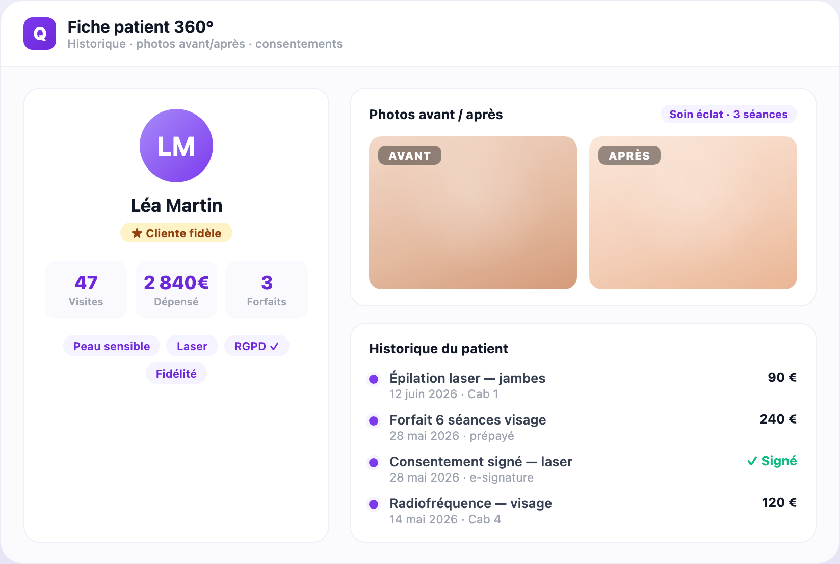 360 patient profile in Qleven